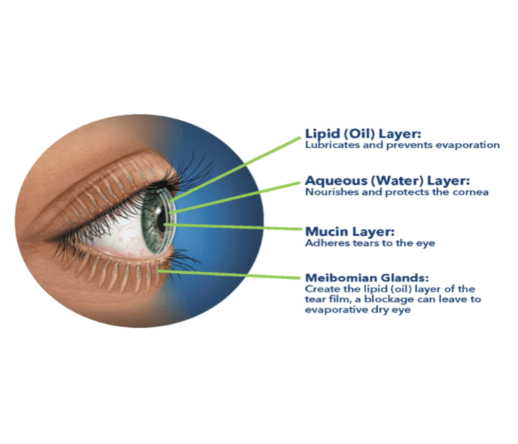 You’ve got Dry Eye Disease